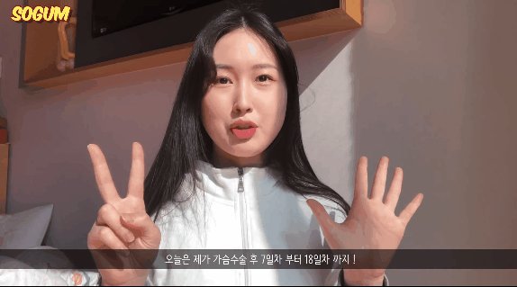 박소금 ☆ 귀여운 유튜버 가슴수술 브이로그 2V